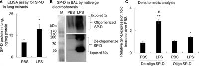 Lower Oligomeric Form of Surfactant Protein D in Murine Acute Lung Injury Induces M1 Subtype Macrophages Through Calreticulin/p38 MAPK Signaling Pathway